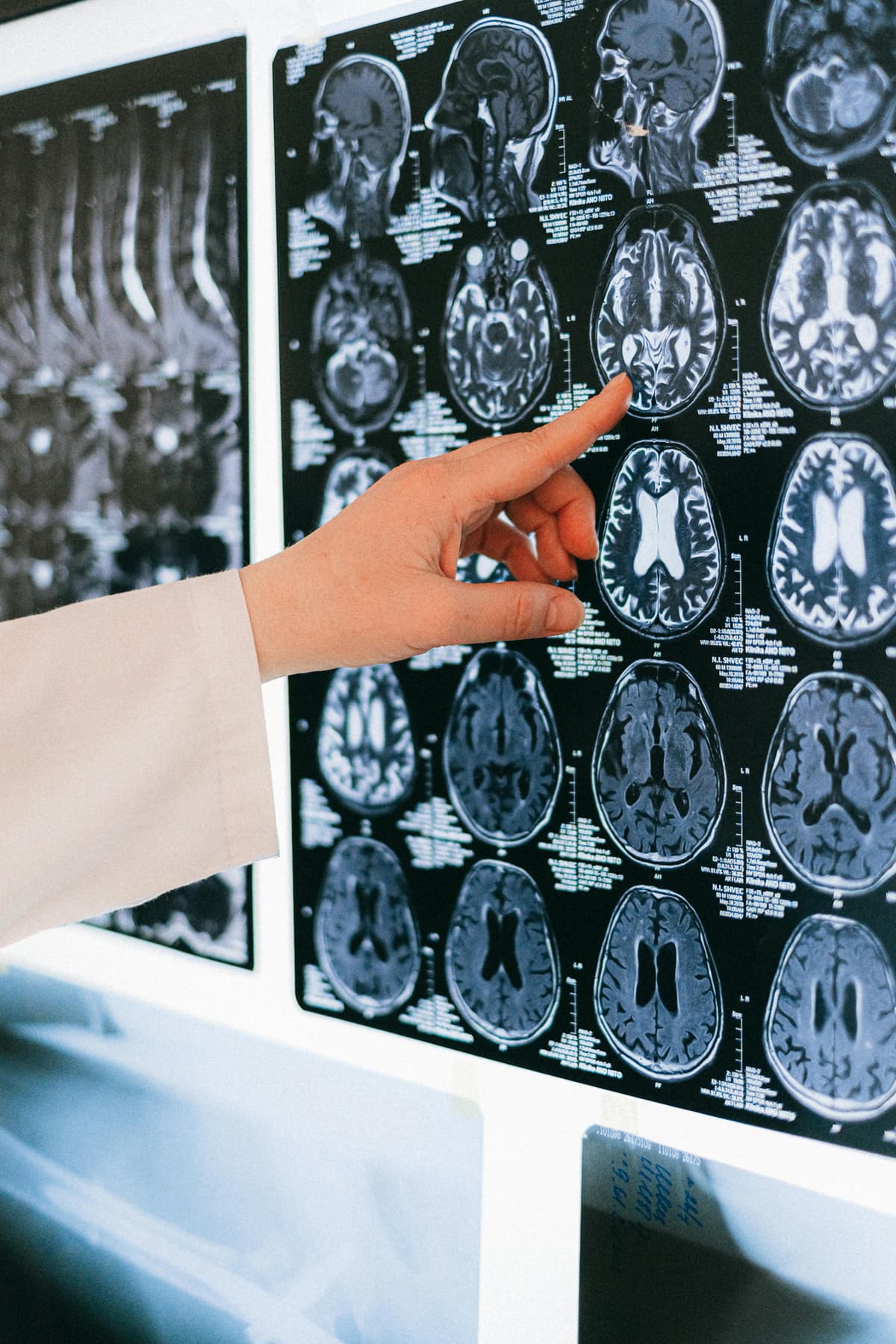 Healthcare AI's 95% Failure Rate: Optura's $17.5M Fix